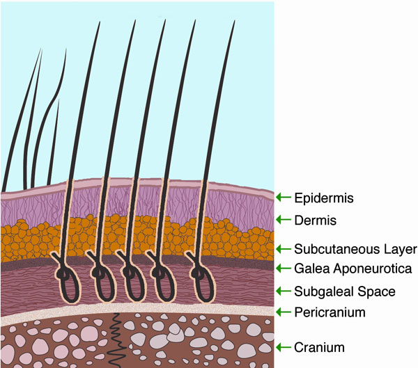 trapianto capelli sintetici